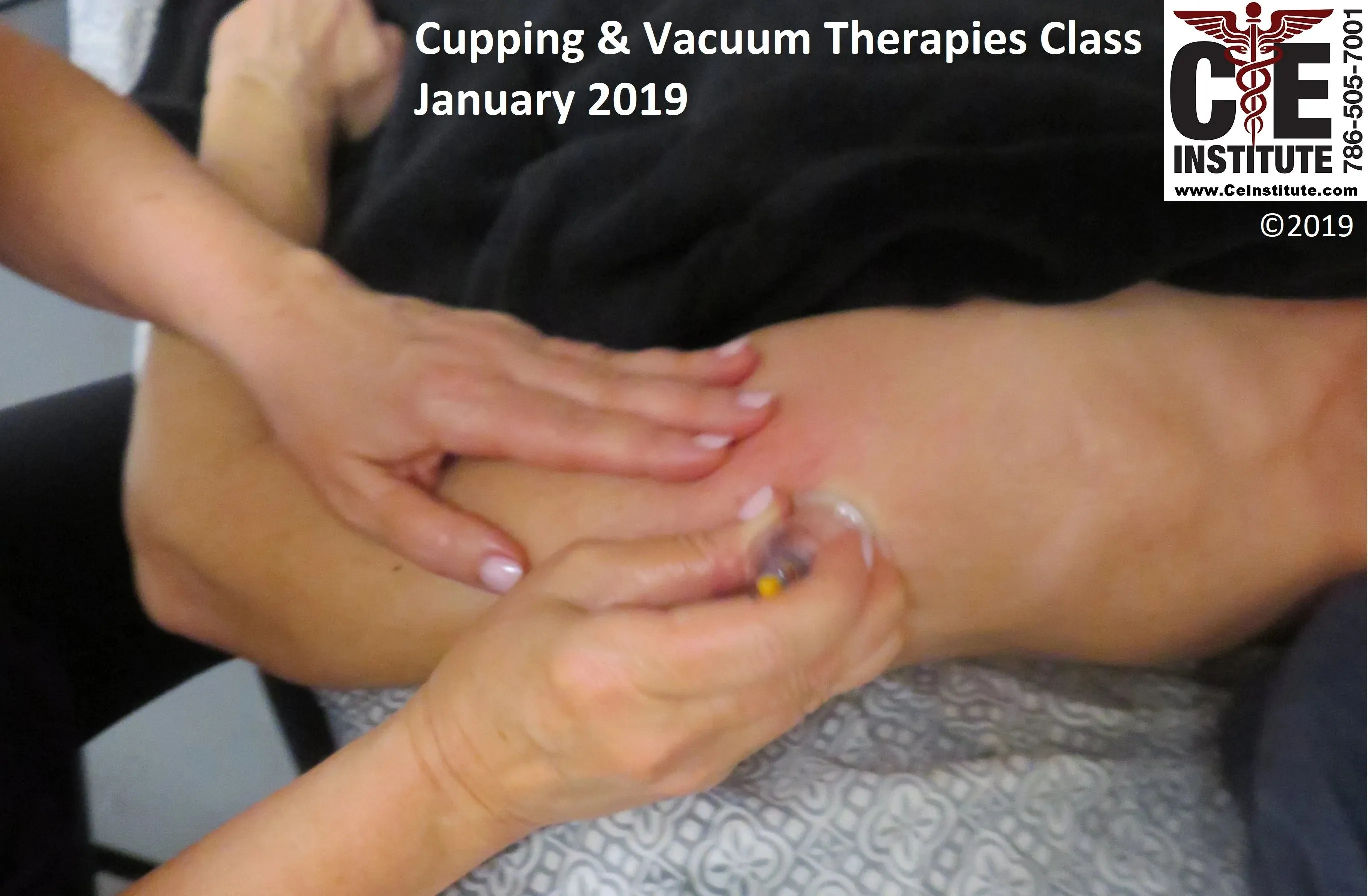 LIVE IN-PERSON 12 CE Hour Orthopedic Cupping